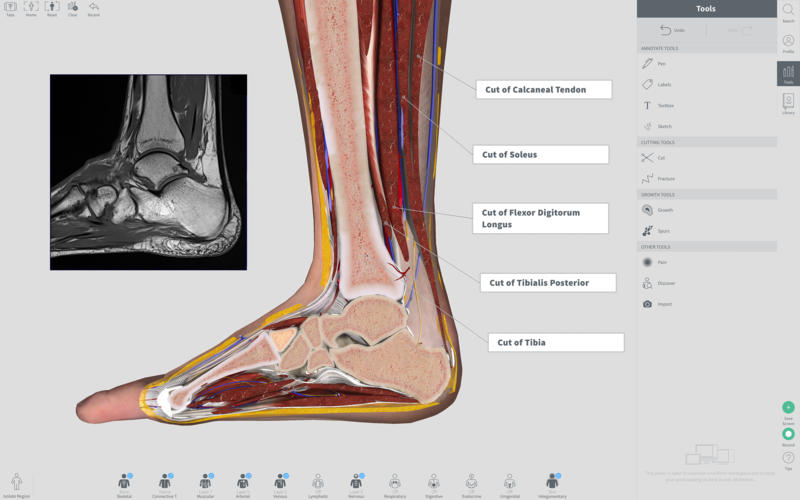 Complete Anatomy 2019 4.0.1 Mac 破解版 – 强大的3D医学人体模型-日主题 Complete Anatomy 2019 4.0.1 Mac 破解版 – 强大的3D医学人体模型